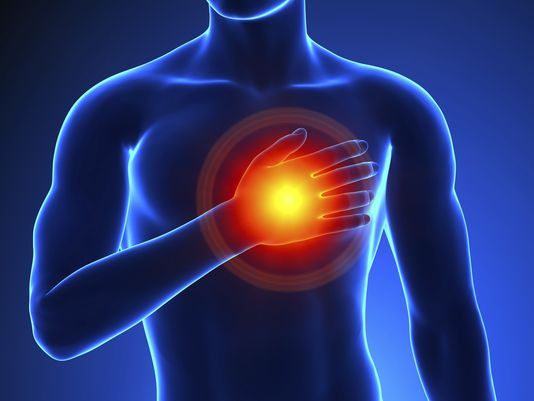 cardiac arrest