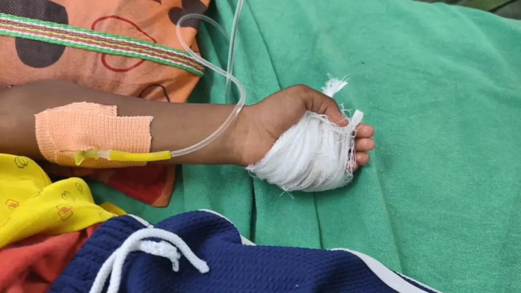 Doctor Operates on Wrong Hand of 6-Year-Old in Maharashtra Hospital; Probe Committee Formed